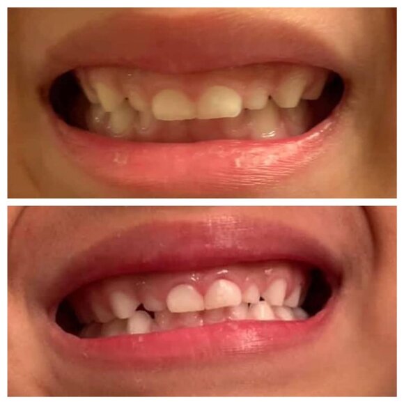 NuSkin Whitening Toothpaste (2-pack) - Picture 3 of 3